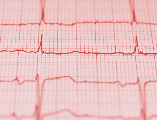 Optimización fiscal mediante la oferta de seguro de salud como retribución flexible en el IRPF